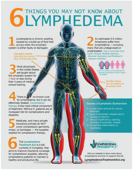 6 Things You May Not Know About Lymphedema