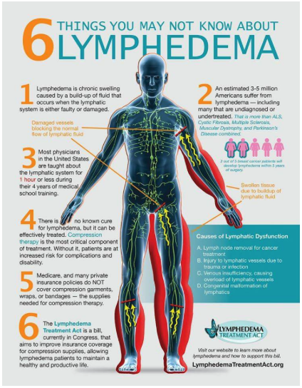 My Under Armor: Do you know about lymphedema? - Cervivor