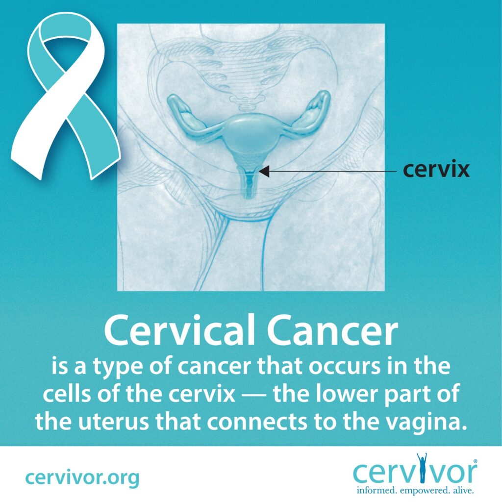 cervical cancer patient journey